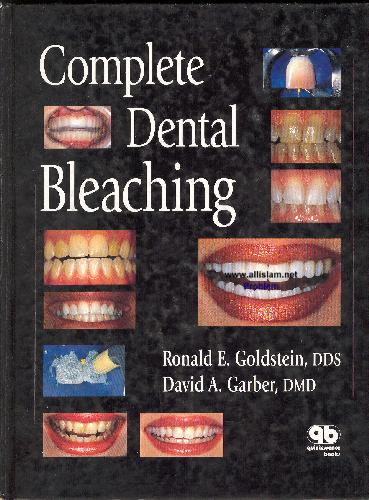 Обложка книги Complete Dental Bleaching