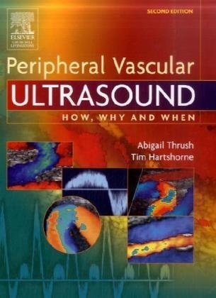 Обложка книги Peripheral Vascular Ultrasound How Why and When
