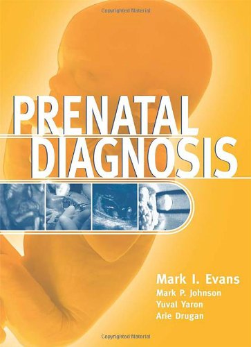 Обложка книги Prenatal Diagnosis