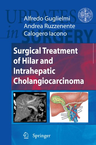 Обложка книги Surgical Treatment of Hilar and Intrahepatic Cholangiocarcinoma
