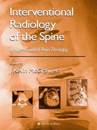 Обложка книги Interventional Radiology in Pain Treatment