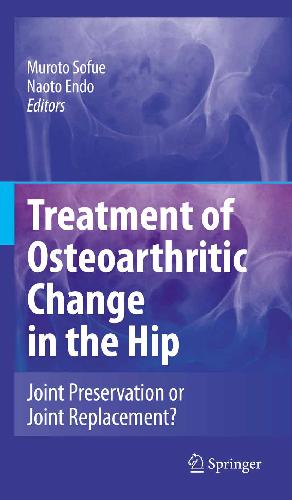 Обложка книги Sofue Treatment of Osteoarthritic Change in the Hip-Joint Preservation or Joint Replacement