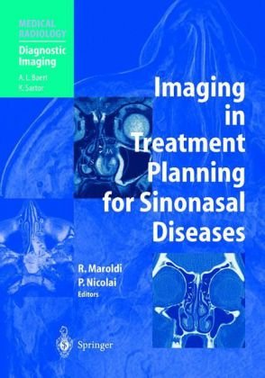 Обложка книги Imaging in Treatment Planning for Sinonasal Diseases