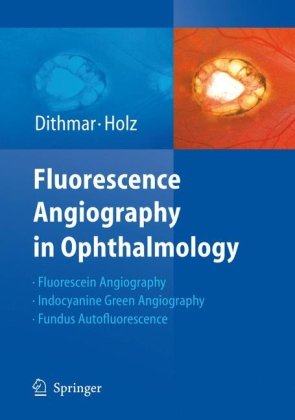 Обложка книги Fluorescence Angiography In Ophthalmology