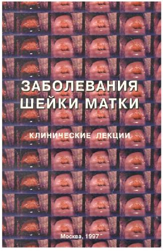 Обложка книги ЗАБOЛЕВАНИЯ ШEЙКИ МAТКИ (Клиничeские лeкции)