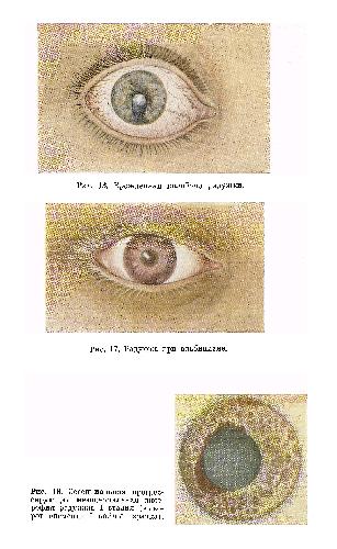 Обложка книги Вельховер - Иридодиагностика (вкладки)