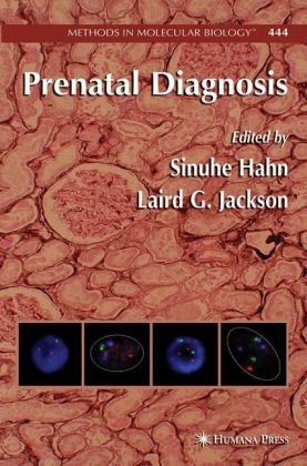 Обложка книги Prenatal Diagnosis