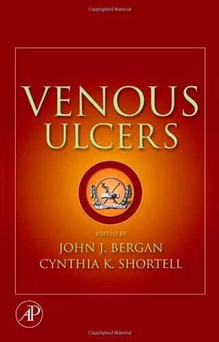 Обложка книги Venous Ulcers