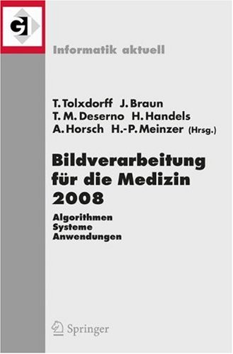 Обложка книги Bildverarbeitung für die Medizin 2008: Algorithmen - Systeme - Anwendungen (Informatik aktuell) (German and English Edition)