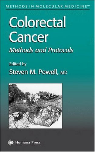 Обложка книги Colorectal Cancer: Methods and Protocols