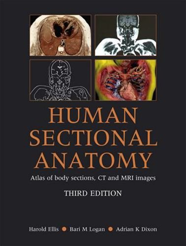 Обложка книги Human Sectional Anatomy: Atlas of Body Sections, CT and MRI Images