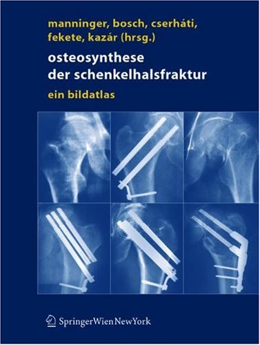 Обложка книги Osteosynthese der Schenkelhalsfraktur: Ein Bildatlas 