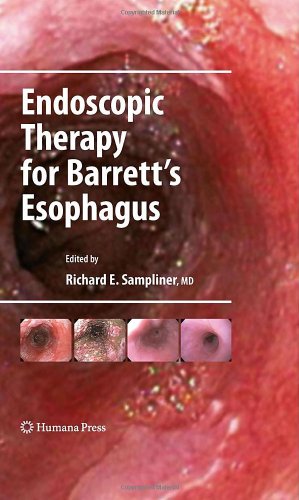 Обложка книги Endoscopic Therapy for Barrett's Esophagus (Clinical Gastroenterology)