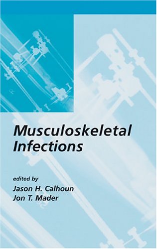 Обложка книги Musculoskeletal Infections