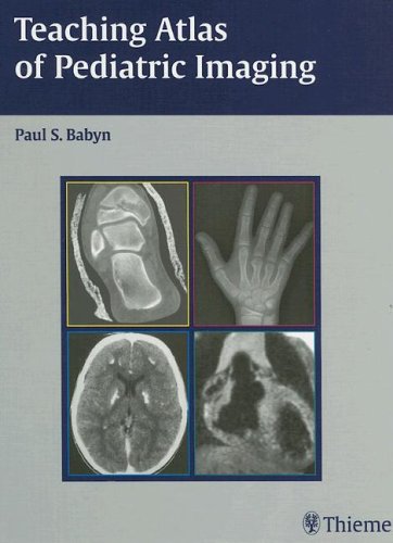 Обложка книги Teaching Atlas of Pediatric Imaging (Teaching Atlas Series)
