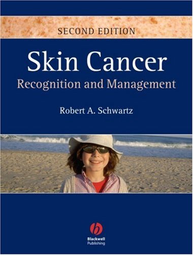 Обложка книги Skin Cancer: Recognition and Management 2nd Edition