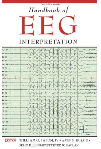 Обложка книги Handbook of EEG Interpretation