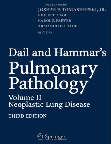 Обложка книги Dail and Hammar's Pulmonary Pathology, Third Edition: Volume II: Neoplastic Lung Disease
