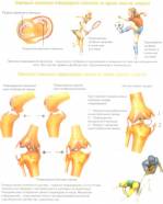 Обложка книги Переломы костей и повреждения суставов