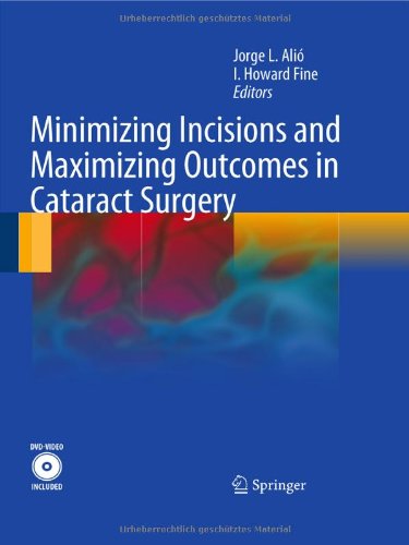 Обложка книги Minimizing Incisions and Maximizing Outcomes in Cataract Surgery