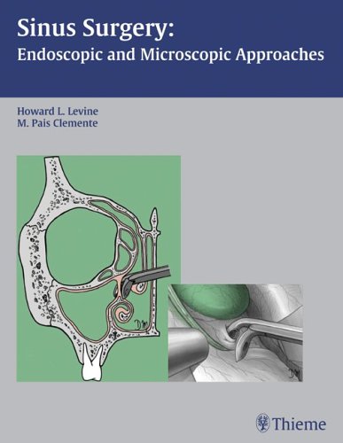 Обложка книги Sinus Surgery: Endoscopic And Microscopic Approaches