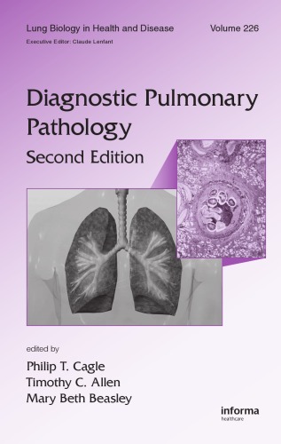 Обложка книги Lung Biology in Health and Disease Volume 226 Diagnostic Pulmonary Pathology 2nd Edition