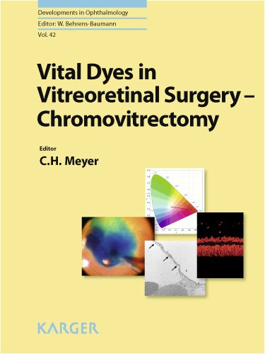 Обложка книги Vital Dyes in Vitreoretinal Surgery: Chromovitrectomy (Developments in Ophthalmology, Vol. 42)
