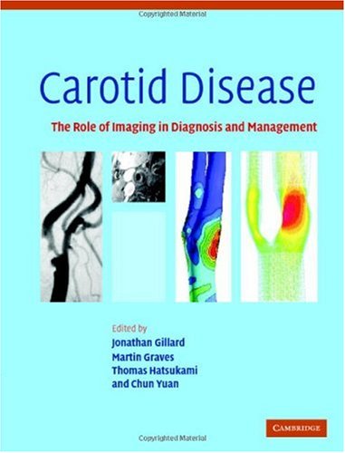 Обложка книги Carotid Disease: The Role of Imaging in Diagnosis and Management