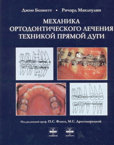 Обложка книги Механика ортодонтического лечения техникой прямой дуги
