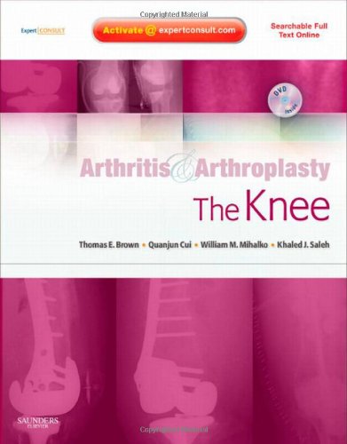 Обложка книги Arthritis and Arthroplasty: The Knee  
