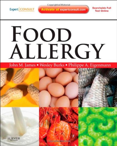 Обложка книги Food Allergy: Expert Consult Basic  
