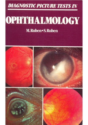 Обложка книги Diagnostic Picture Tests in Ophthalmology  