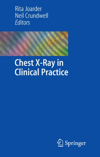 Обложка книги Chest X-Ray in Clinical Practice  