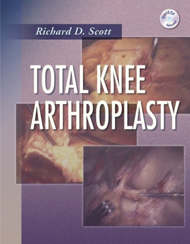 Обложка книги Total Knee Arthroplasty  