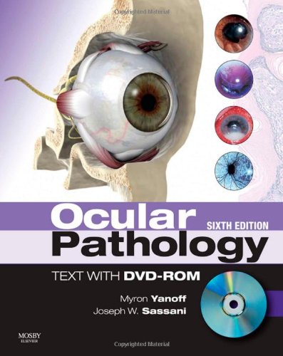 Обложка книги Ocular pathology  