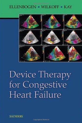 Обложка книги Device Therapy for Congestive Heart Failure  