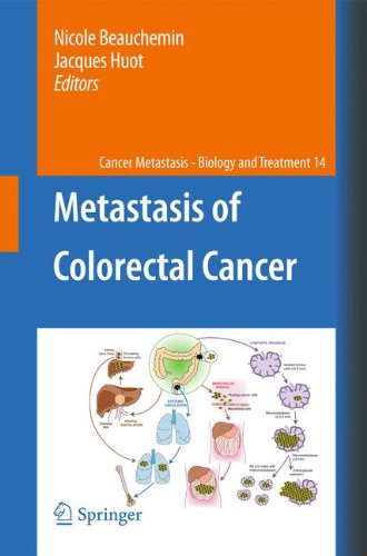 Обложка книги Metastasis of Colorectal Cancer  